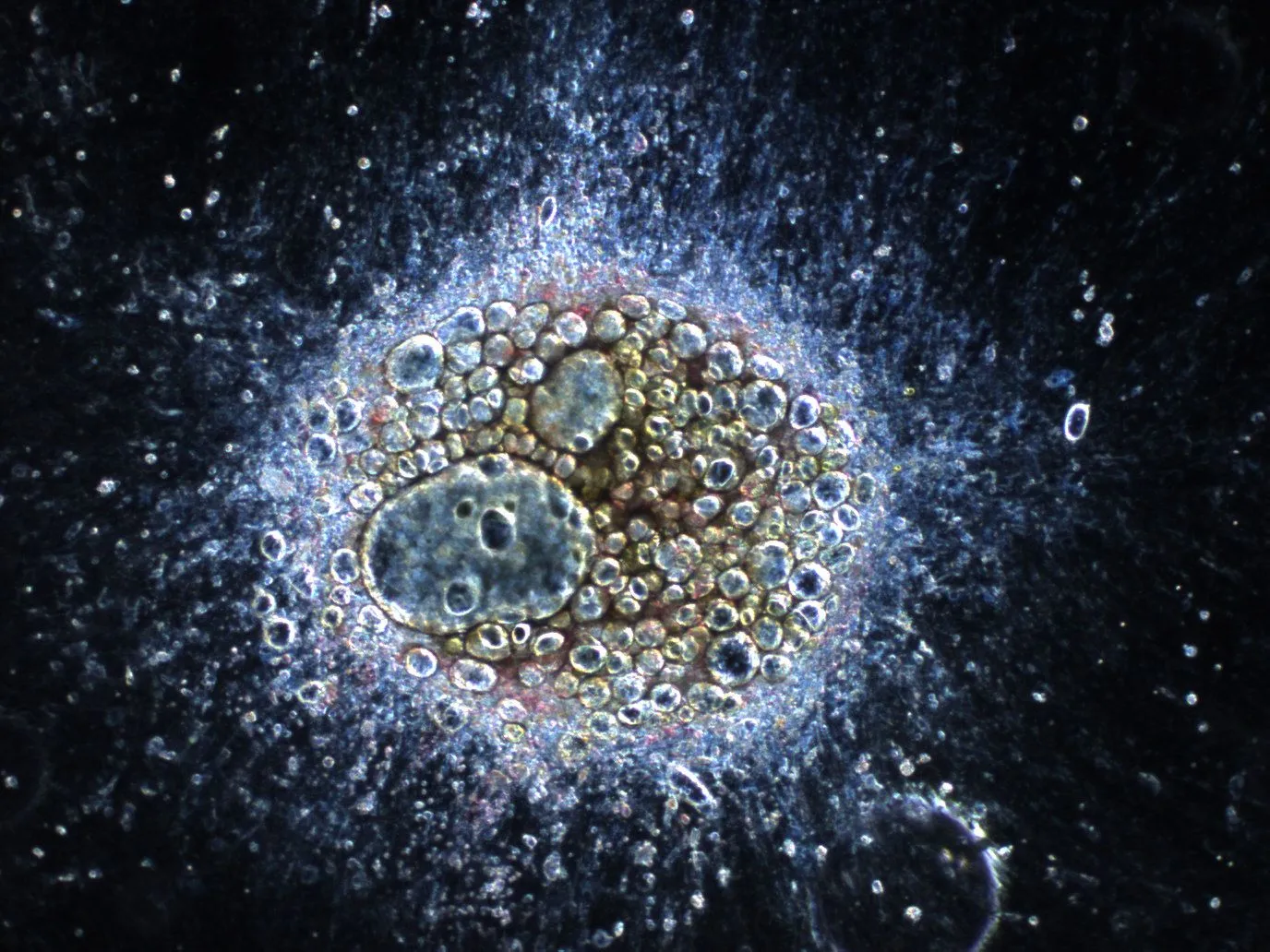 Dark-field image of a bone marrow explant with a ring of outgrowing stromal cells.