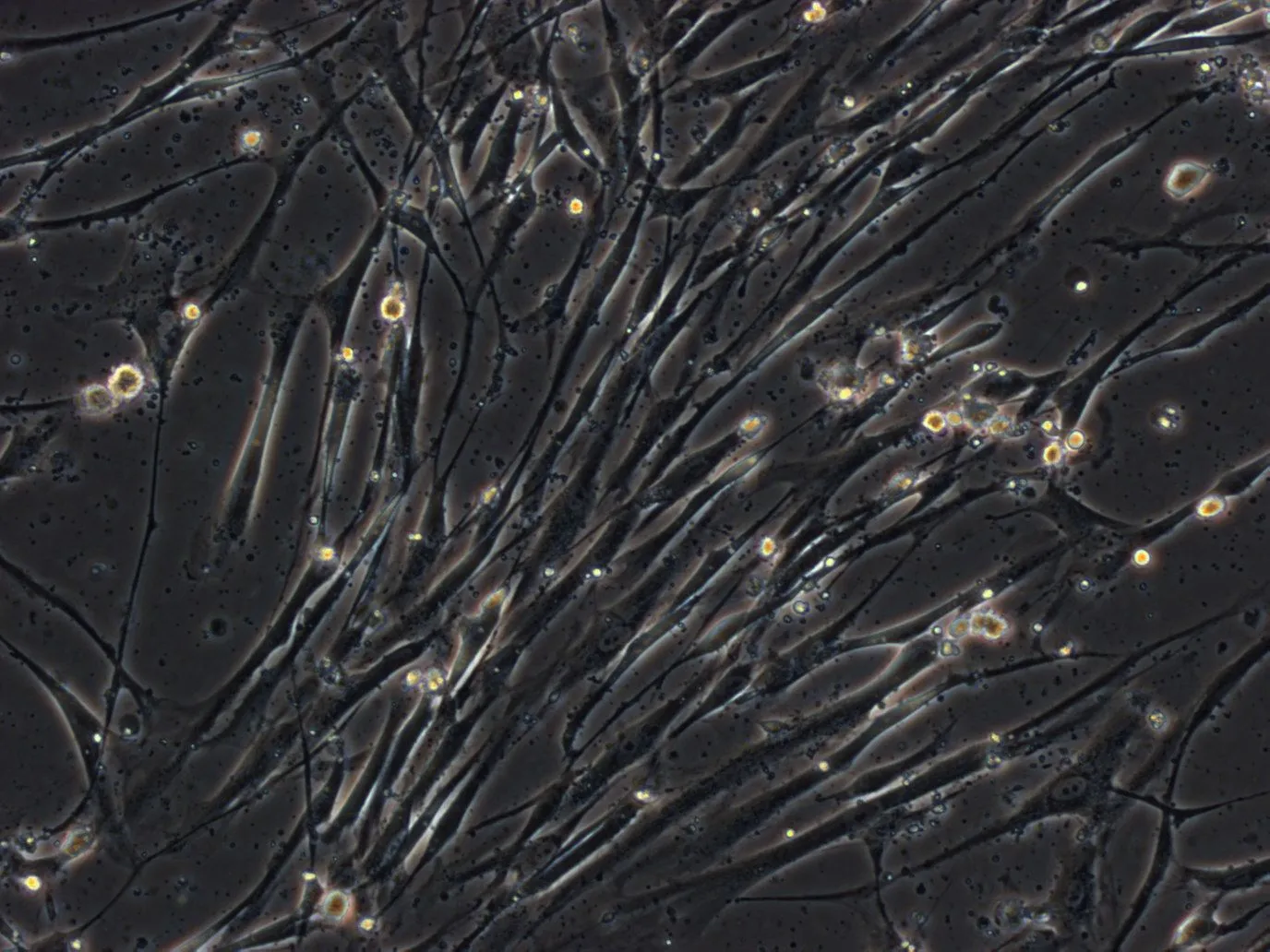 Phase contrast: densely grown, spindle-shaped bone marrow mesenchymal stromal cells.