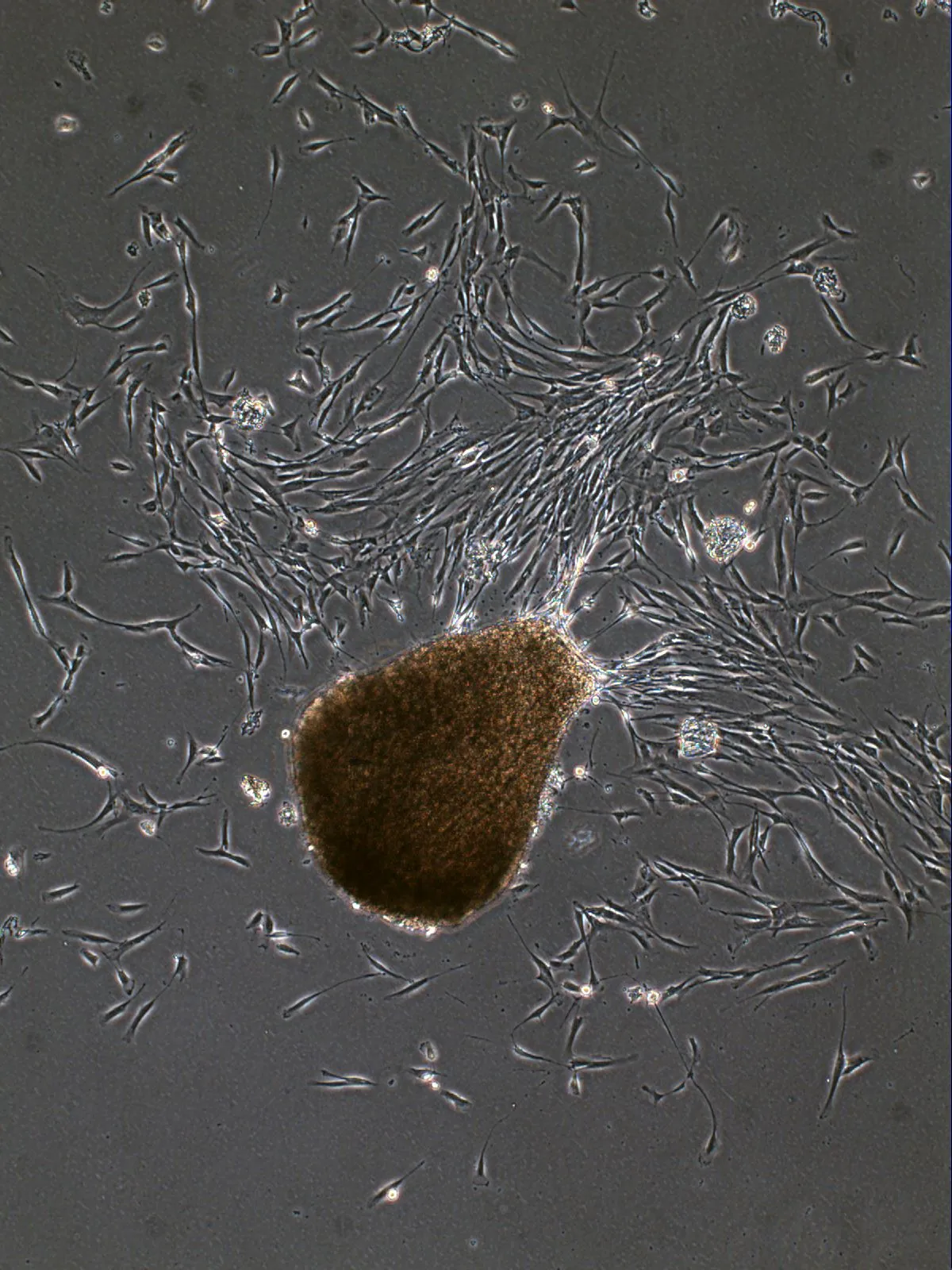 Phase contrast: fibroblasts migrating outward in all directions from a tissue explant.