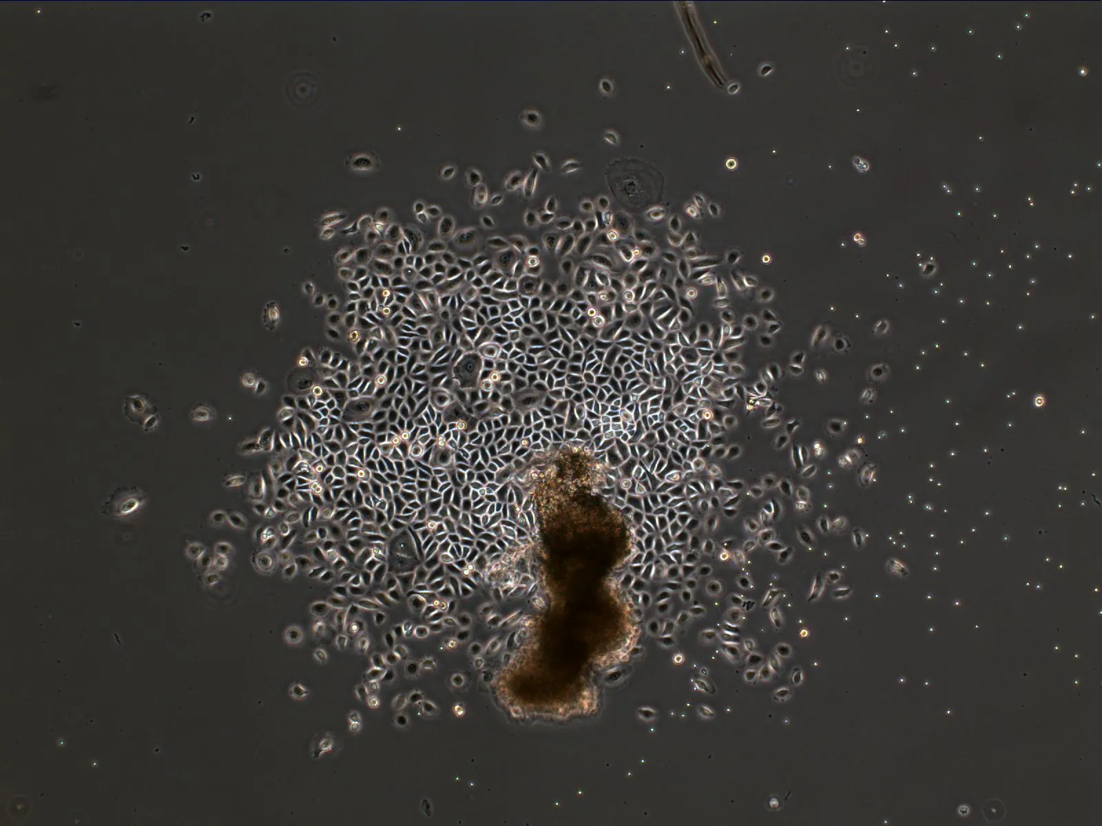 Phase contrast: a colony of human gingiva cells with cells migrating outward.
