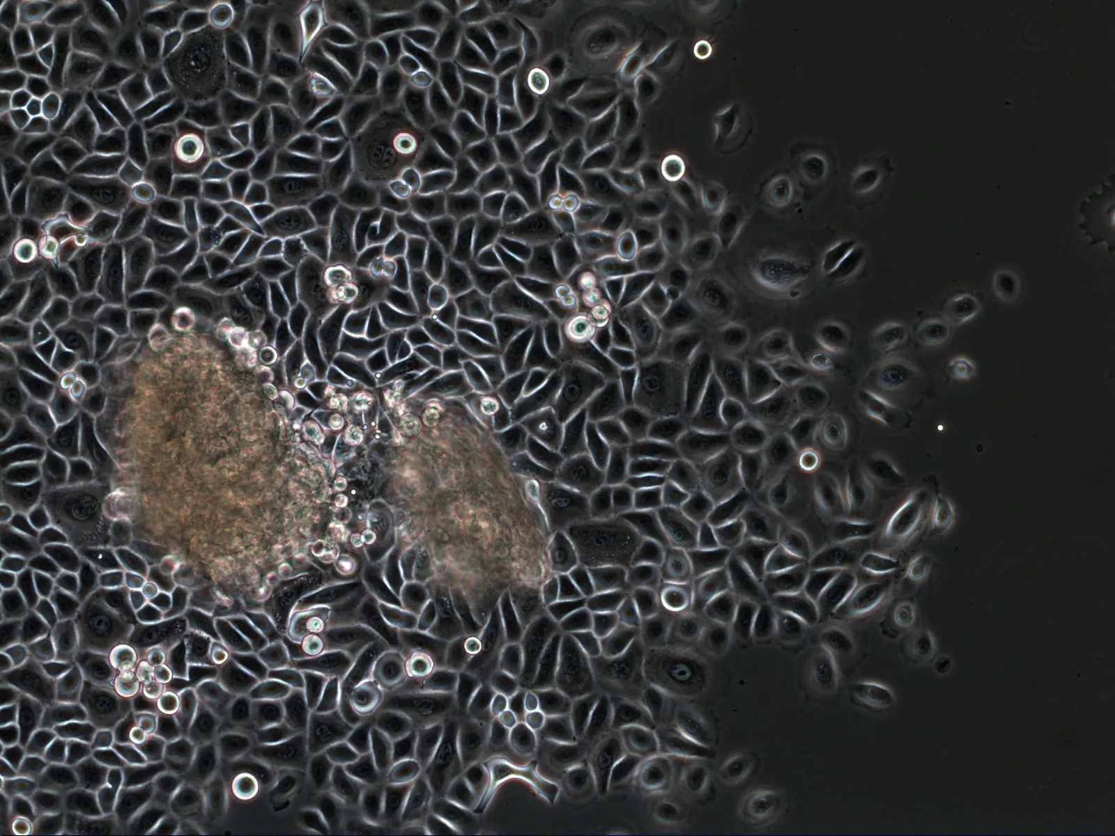 Phase contrast: epithelial keratinocytes in a cobblestone pattern at the edge of a gingiva explant.