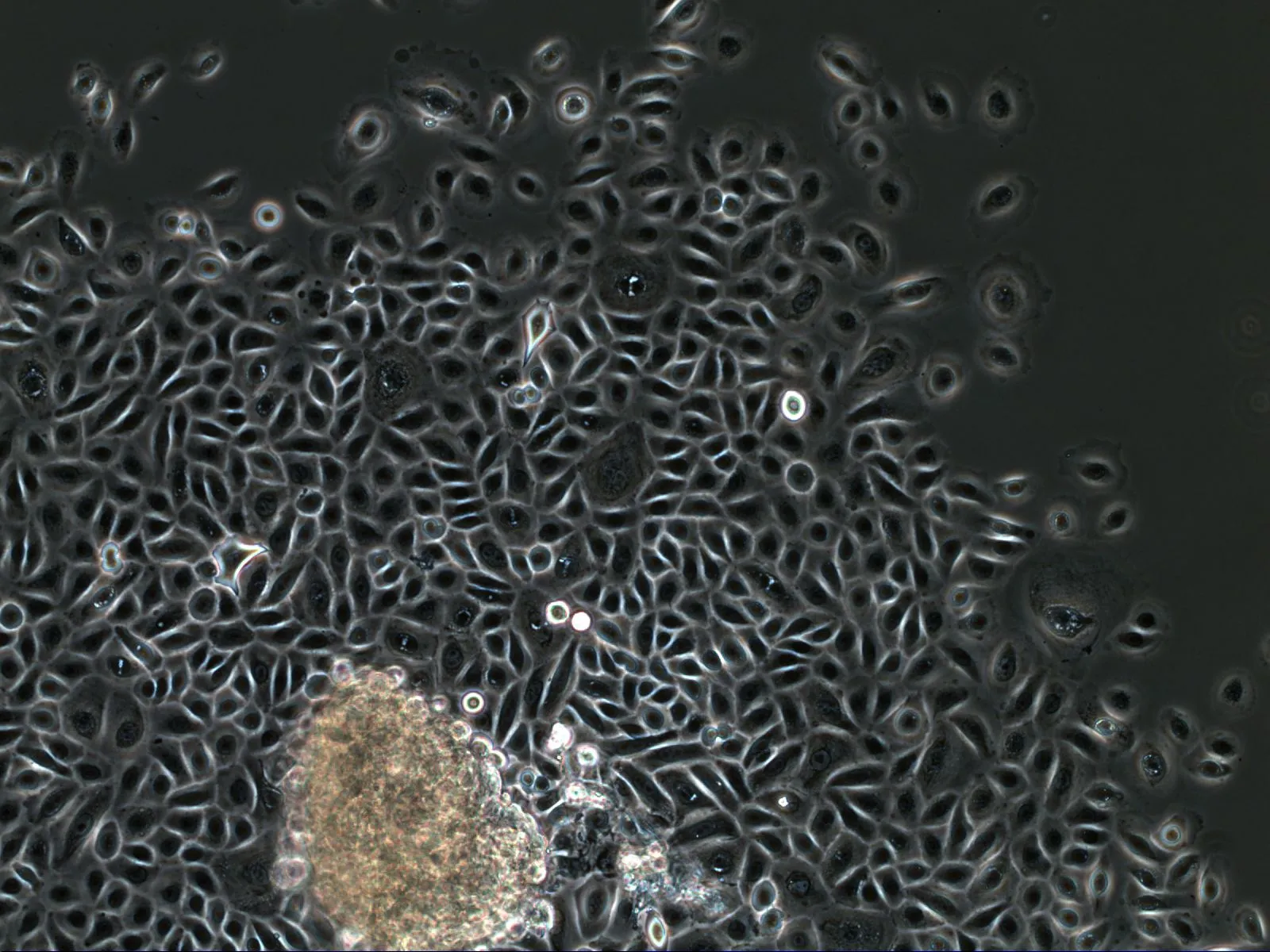 Phase contrast: a dense, single-layer epithelial sheet of human gingiva.
