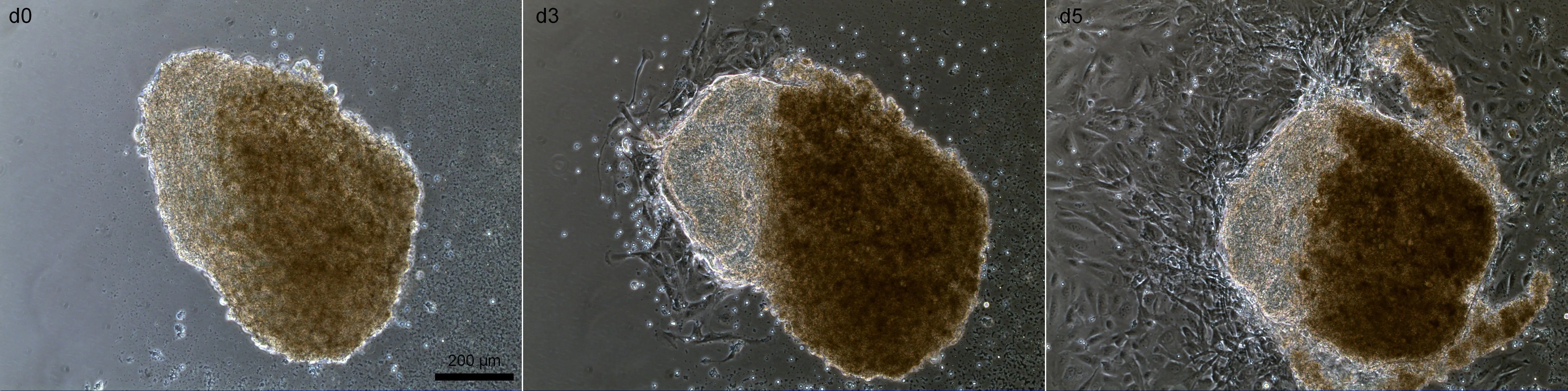 Phase-contrast time series: cells growing out from a human liver explant over five days.